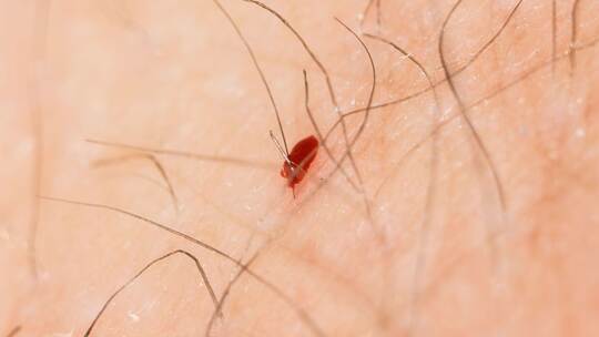 Bremsen wieder unterwegs - was hilft gegen die Blutsauger? Bremsen wieder unterwegs - was hilft gegen die Blutsauger?