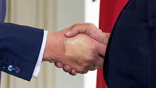 Weißes Haus: Trump hat chronisch venöse Insuffizienz