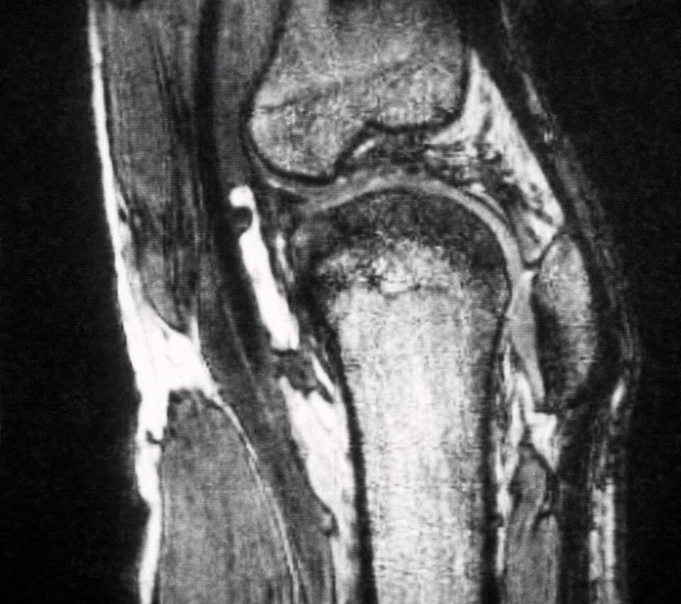 Röntgenaufnahme eines Kniegelenks