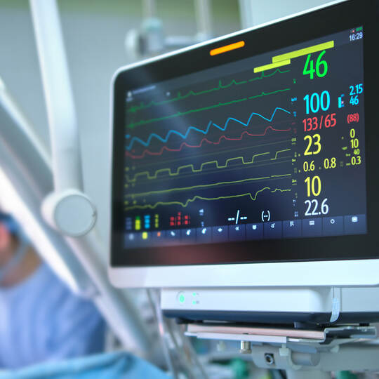 Heart rate and patient condition control monitor in hospital theater room during surgery operation
