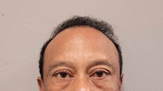 US-Golfstar Tiger Woods in Autounfall verwickelt