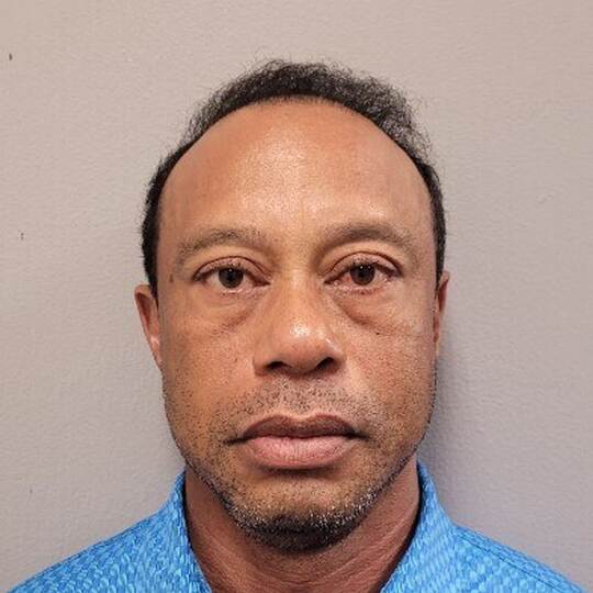 US-Golfstar Tiger Woods in Autounfall verwickelt