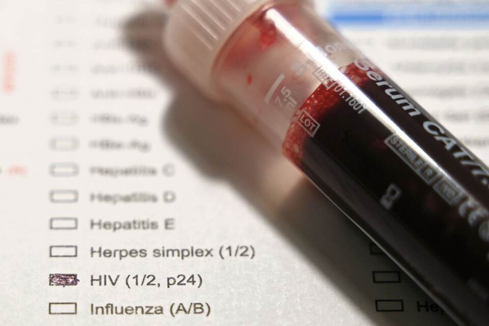 HIV-Untersuchung