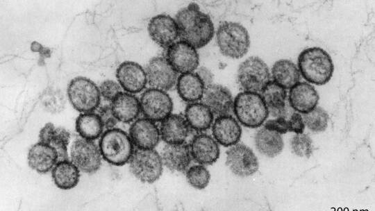 Hantavirus