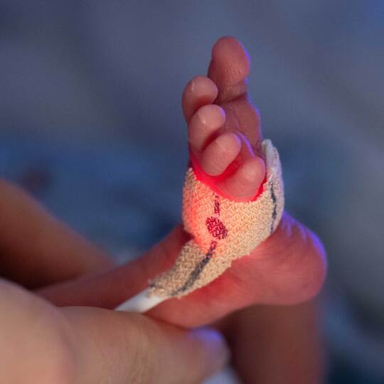 Darmkeim-Infektionen in Kinderklinik: Frühchen gestorben