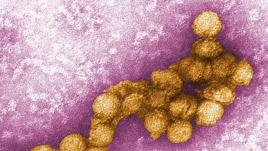 West-Nil-Virus West-Nil-Virus