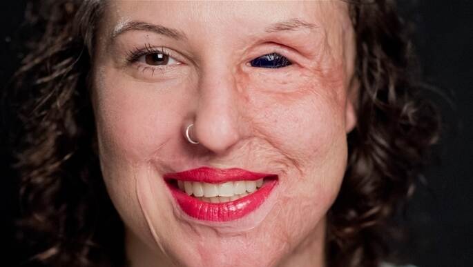 Die 29-jährige Vanessa Münstermann sagt von sich selbst, sie habe zwei Gesichter.