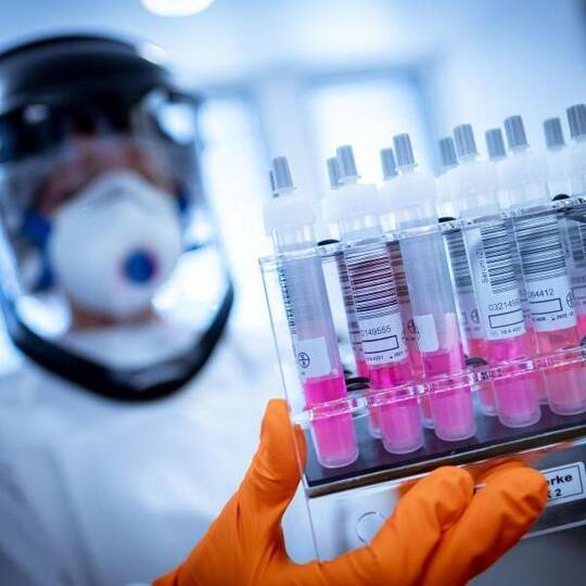 Coronavirus-Testproben im Niedersächsischen Landesamt für Verbraucherschutz und Lebensmittelsicherheit. Foto: Peter Stef Coronavirus-Testproben im Niedersächsischen Landesamt für Verbraucherschutz und Lebensmittelsicherheit. Foto: Peter Stef