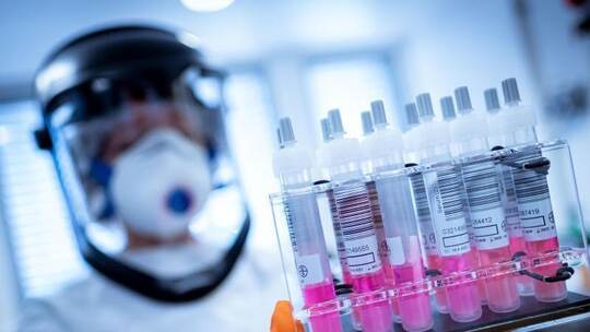 Coronavirus-Testproben im Niedersächsischen Landesamt für Verbraucherschutz und Lebensmittelsicherheit. Foto: Peter Stef