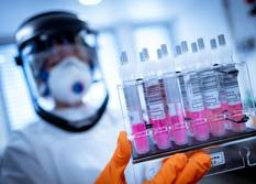 Coronavirus-Testproben im Niedersächsischen Landesamt für Verbraucherschutz und Lebensmittelsicherheit. Foto: Peter Stef