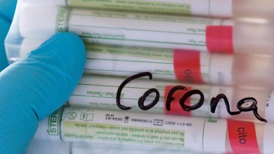 Proben für Corona-Tests werden für die weitere Untersuchung vorbereitet. Die Zahl der Infektionen nimmt in Deutschland w Proben für Corona-Tests werden für die weitere Untersuchung vorbereitet. Die Zahl der Infektionen nimmt in Deutschland w