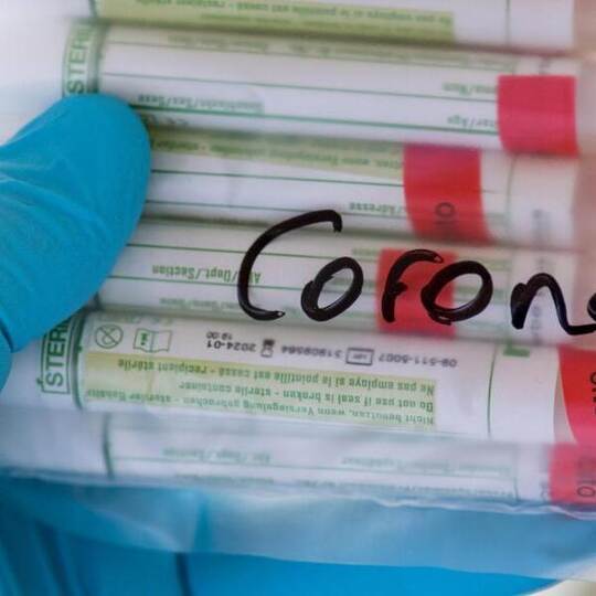 Proben für Corona-Tests werden für die weitere Untersuchung vorbereitet. Die Zahl der Infektionen nimmt in Deutschland w