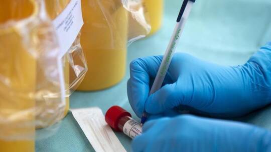 Corona Zahlen 22.04.