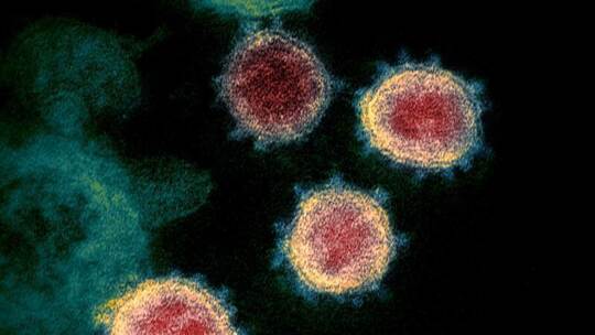 Die elektronenmikroskopische Aufnahme zeigt das Coronavirus SARS-CoV-2. Foto: Uncredited/NIAID-RML/AP/dpa Die elektronenmikroskopische Aufnahme zeigt das Coronavirus SARS-CoV-2. Foto: Uncredited/NIAID-RML/AP/dpa