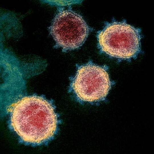 Die elektronenmikroskopische Aufnahme zeigt das Coronavirus SARS-CoV-2. Foto: Uncredited/NIAID-RML/AP/dpa Die elektronenmikroskopische Aufnahme zeigt das Coronavirus SARS-CoV-2. Foto: Uncredited/NIAID-RML/AP/dpa