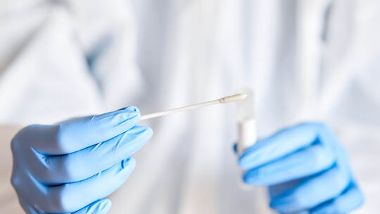 Doctor holding swab test tube for 2019-nCoV analyzing. Coronavirus test. Blue medical gloves and protective face mask for protec
