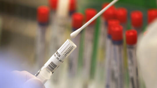 Covid-19-Infektion bedeutet wohl nicht automatisch Immunität