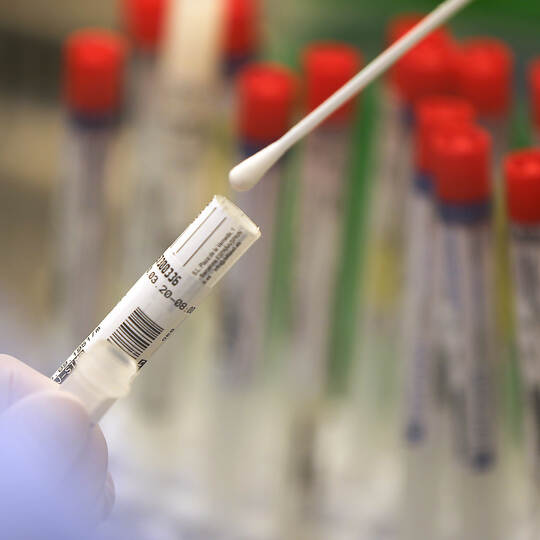 Covid-19-Infektion bedeutet wohl nicht automatisch Immunität
