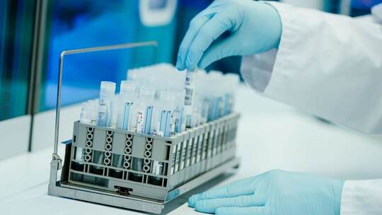 PCR-Test