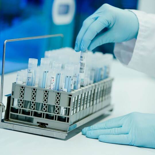 PCR-Test